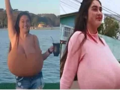 வளர்ந்து கொண்டே இருந்த மார்புகள்! மருத்துவ உலகையே அதிரவைத்த 22 வயது பெண்! வீடியோ