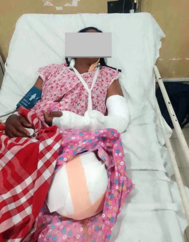 போதை பாவித்து டிப்பர் செலுத்திய சாரதியால் கிளிநொச்சியில் இளம் தாய்க்கு ஏற்பட்ட பேரவலம் : இதற்கு யார் பொறுப்புக் கூறுவது?